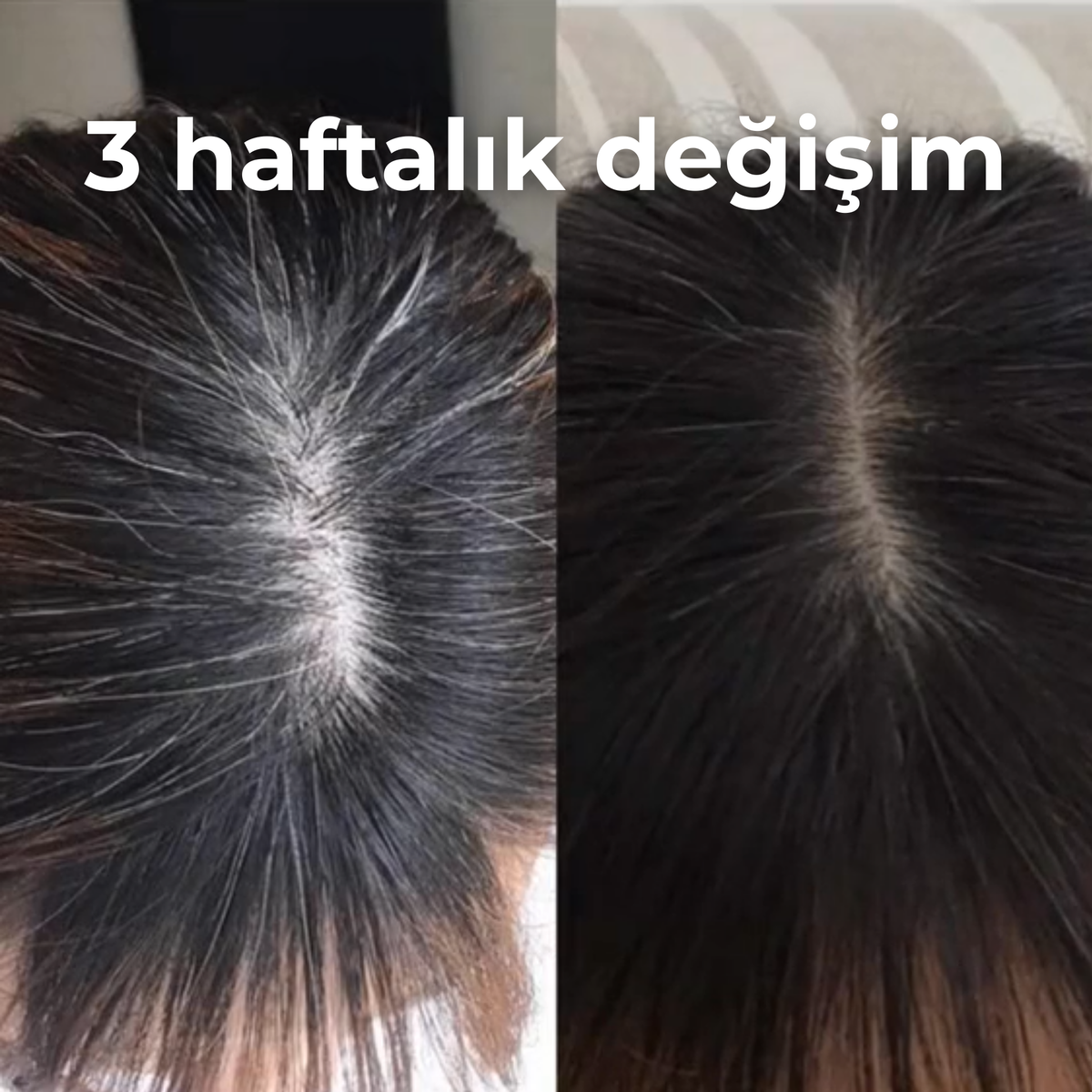 3 haftalık kullanım öncesi ve sonrası