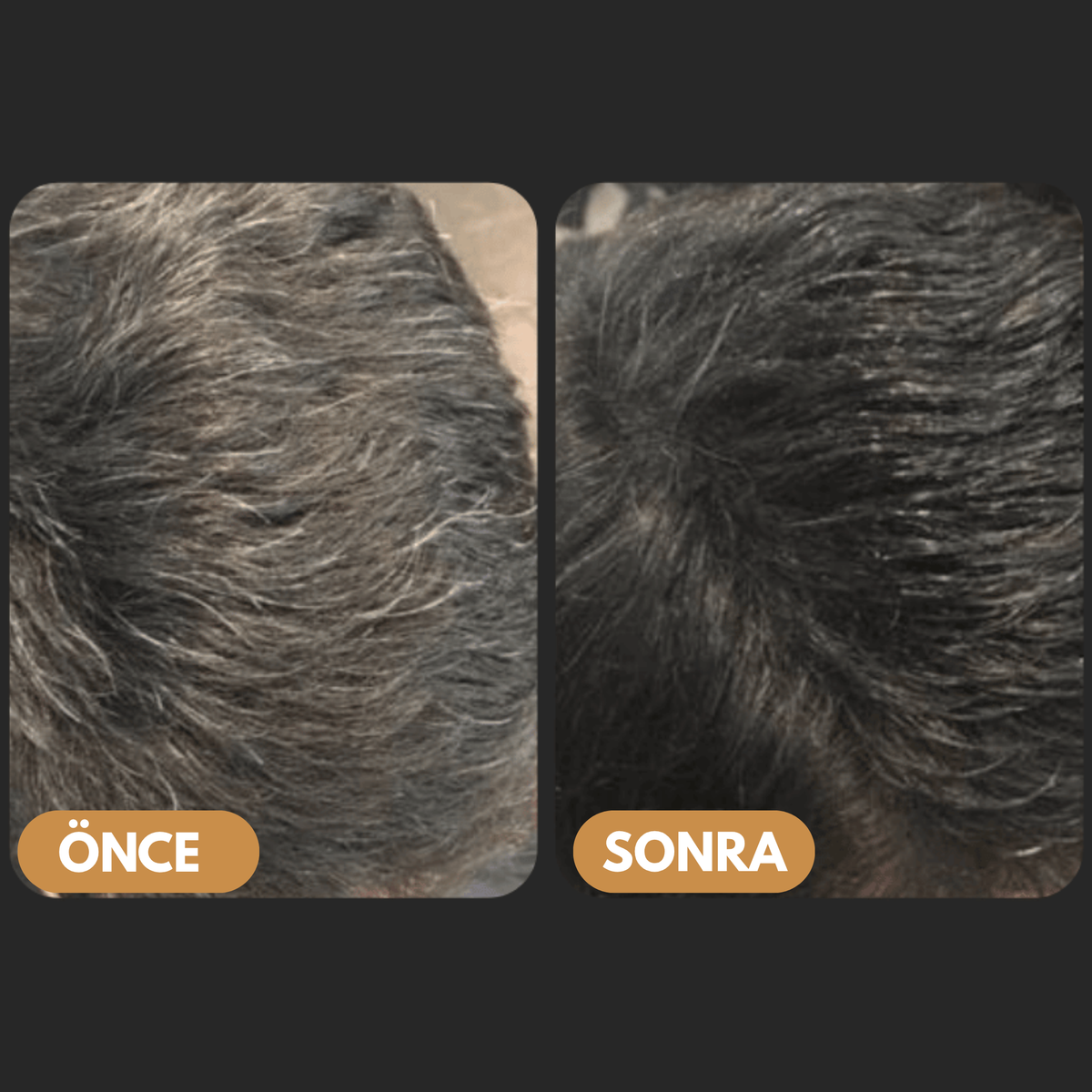 Saç kullanım öncesi ve sonrası