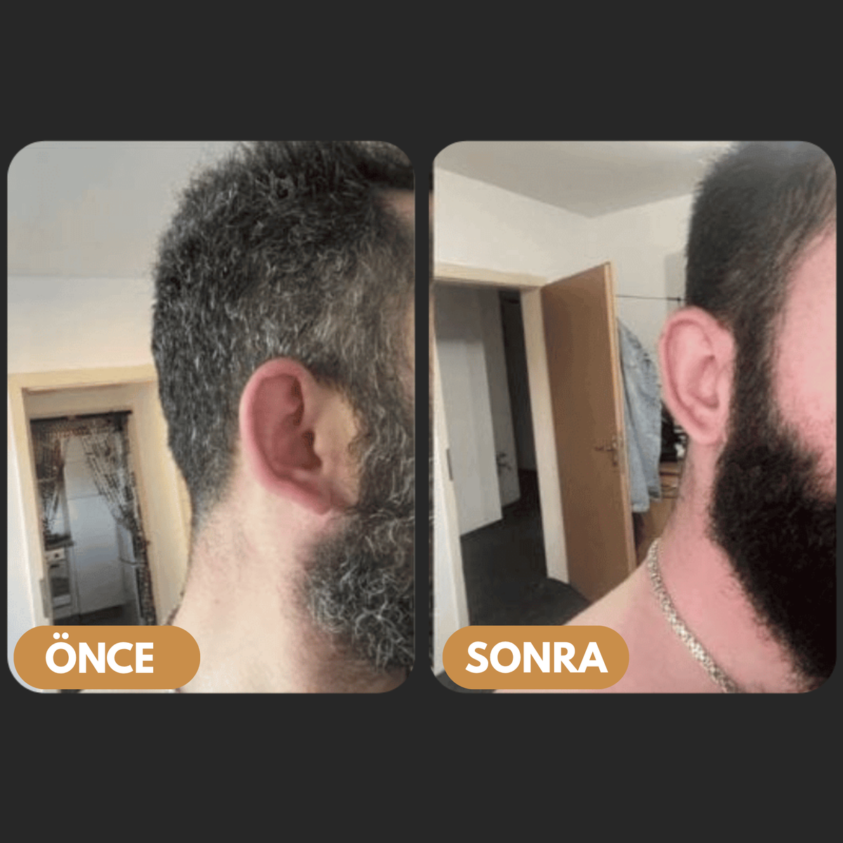 Sakal kullanım öncesi ve sonrası
